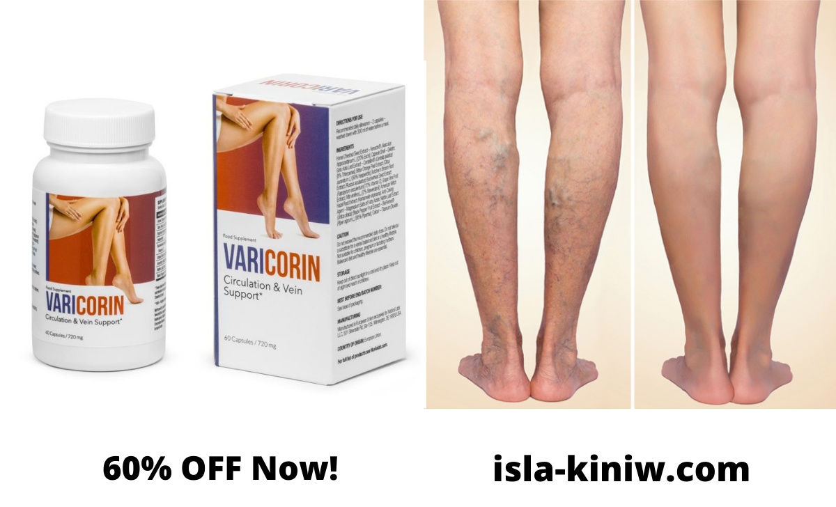 Varicorin Review (Customer Scam!?) does Varicose Veins Supplement work? side effects, Dosage, Ingredients