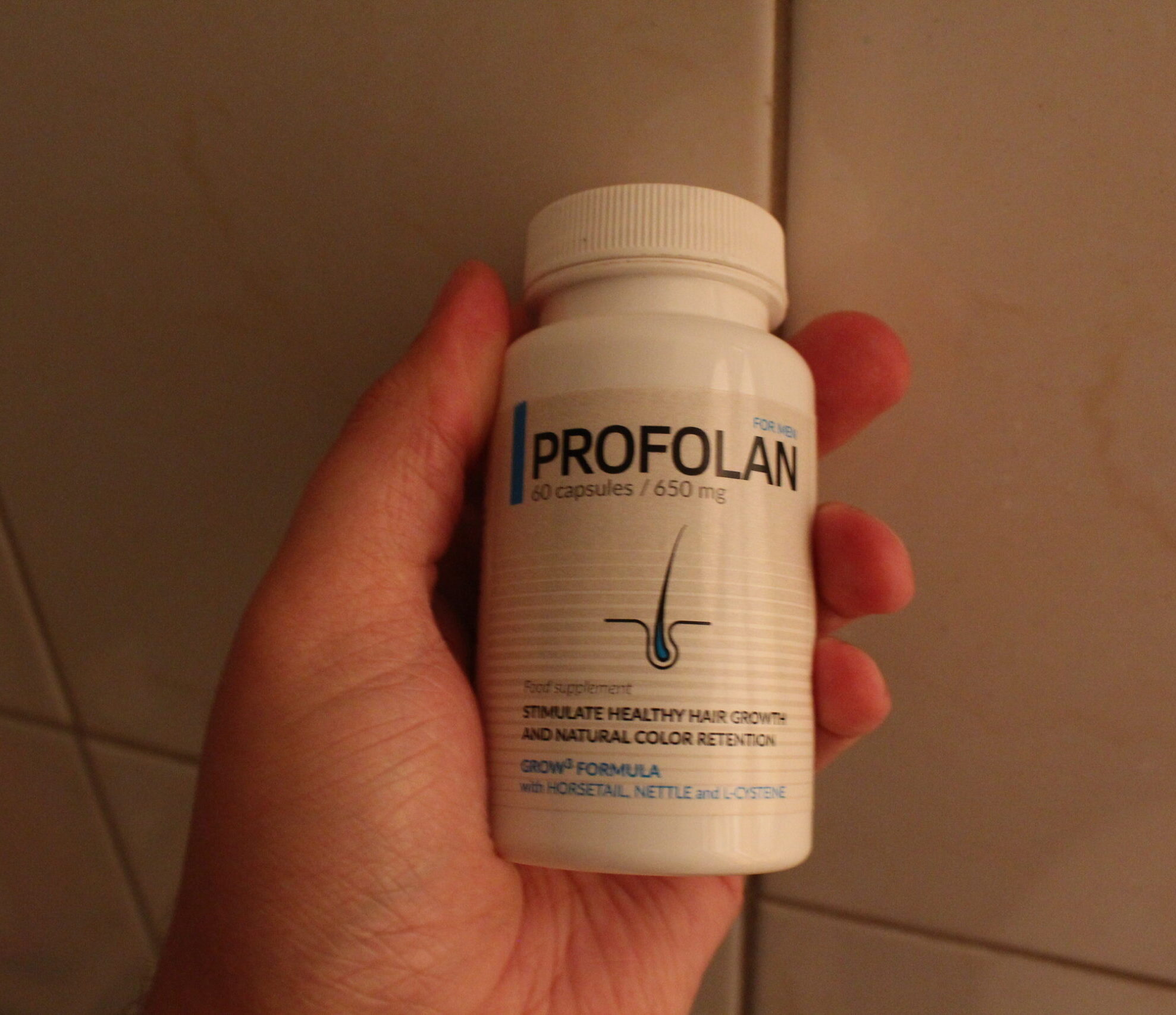 Profolan Hair Loss Supplement Reviews
