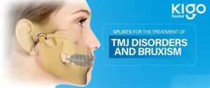 Is Cure TMJ Bruxing a Scam or Legit? Jaw Pain Relief Results & Reviews 4 Cure TMJ Bruxing