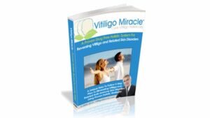 Is Vitiligo Miracle a Scam or Legit? Skin Improvement Claims Revealed 4 Vitiligo Miracle