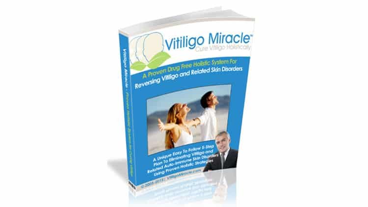 Is Vitiligo Miracle a Scam or Legit? Skin Improvement Claims Revealed 2 Vitiligo Miracle